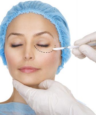 Female in Blue Hairnet With Black Cut Lines Under Left Eye With Doctor Holding Scalpel to Eye